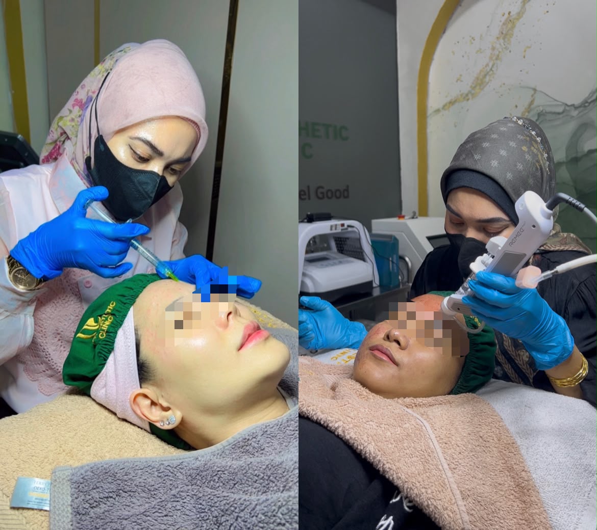 2 Hal yang Tidak Boleh Dilakukan 24 Jam Setelah Skinbooster di Citra Raya, Tangerang