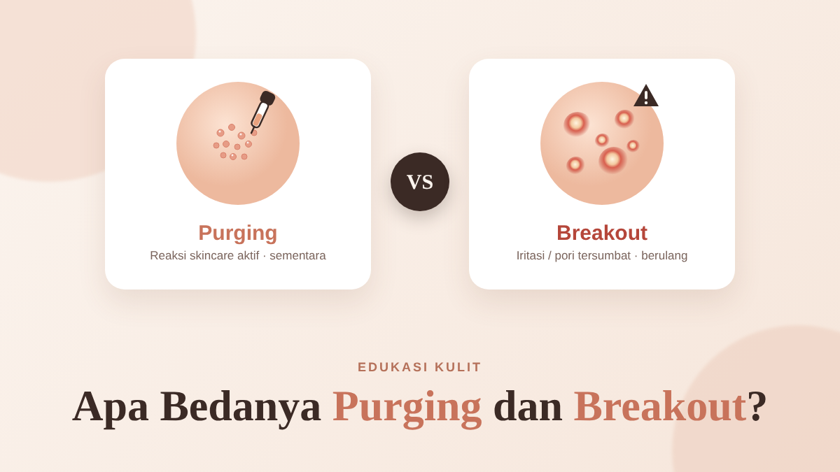 Perbedaan purging dan breakout pada kulit wajah: bintik kecil vs jerawat meradang