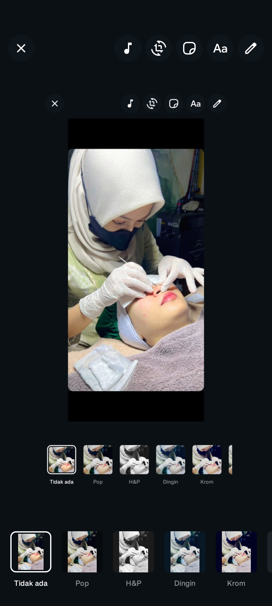Beautician Naba Aesthetic Clinic melakukan ekstraksi komedo saat sesi facial Auto Glow
