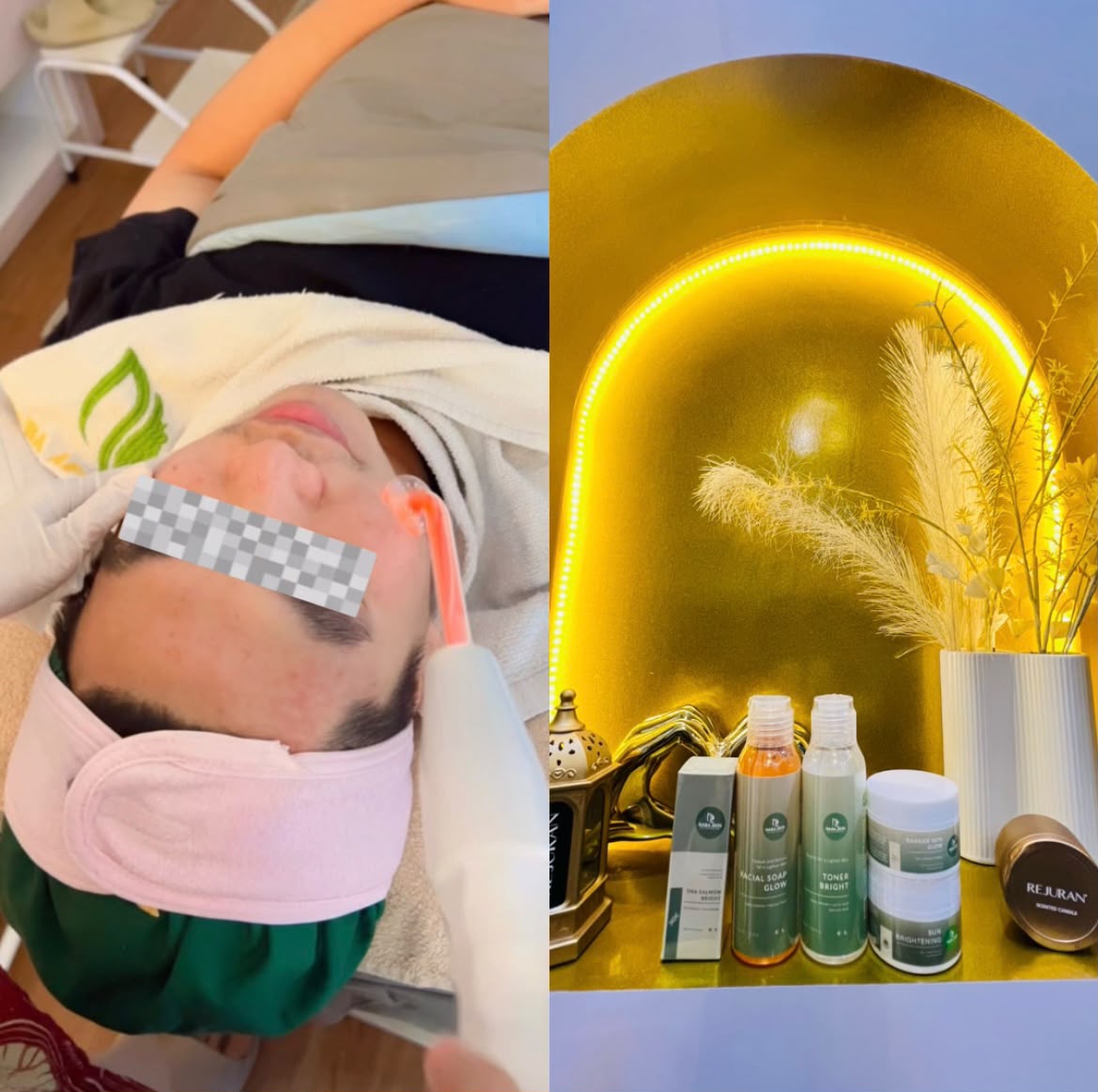 Apakah Boleh Pakai Skincare Langsung Setelah Facial?