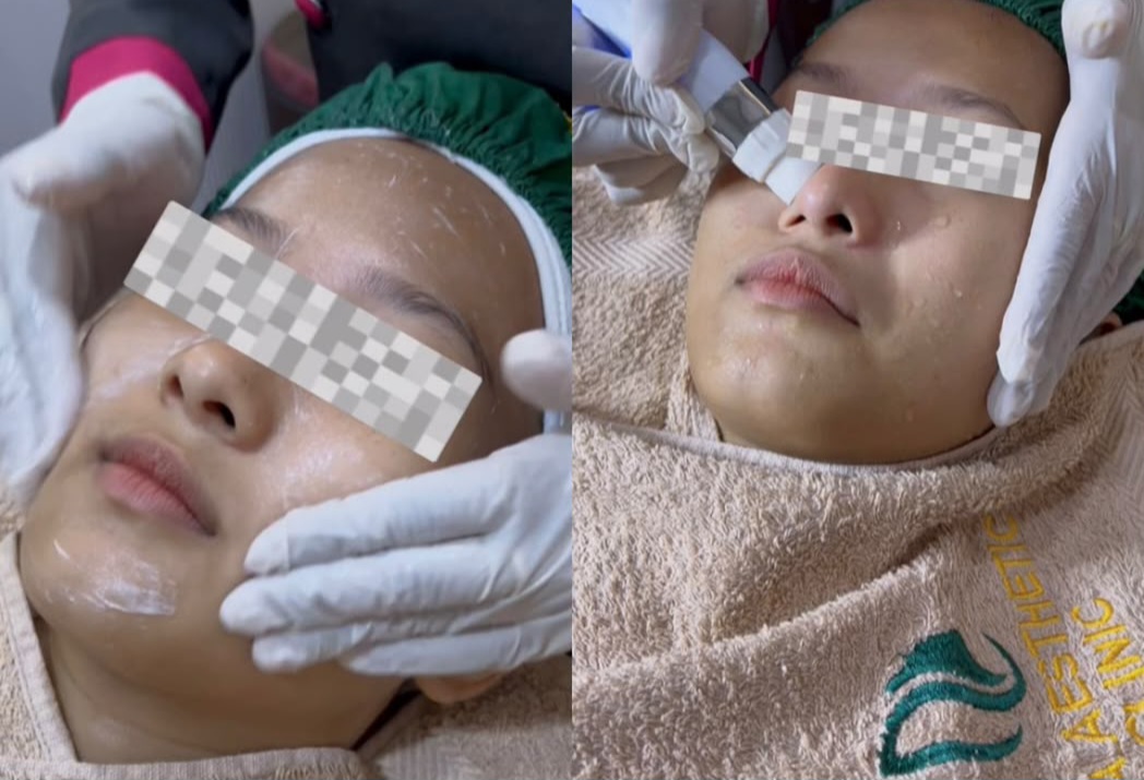 Benarkah Facial Bikin Ketagihan?