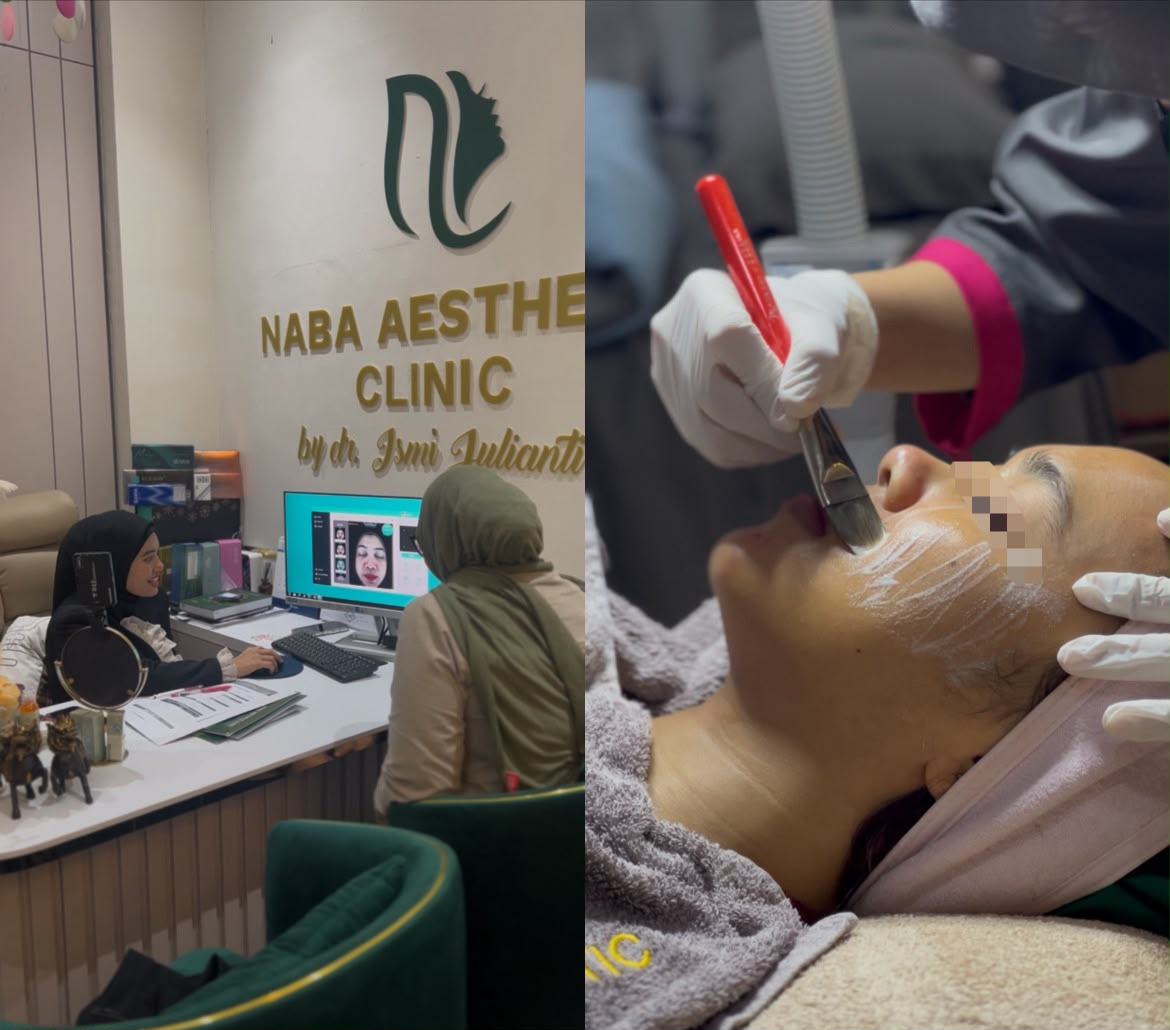 Pasien menjalani facial rutin bulanan di Naba Aesthetic Clinic Citra Raya, Tangerang