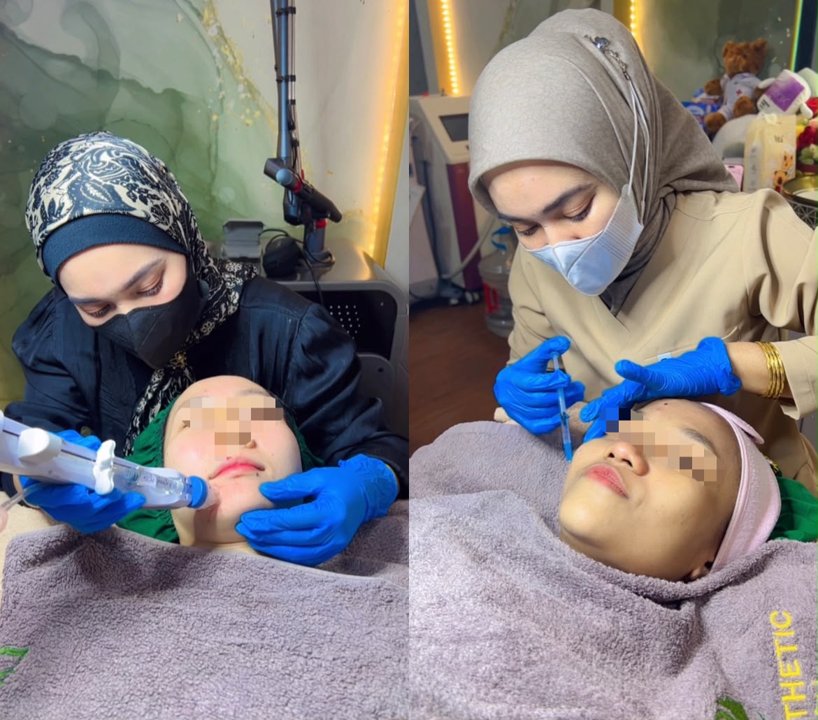 Berapa lama hasil skinbooster bertahan?