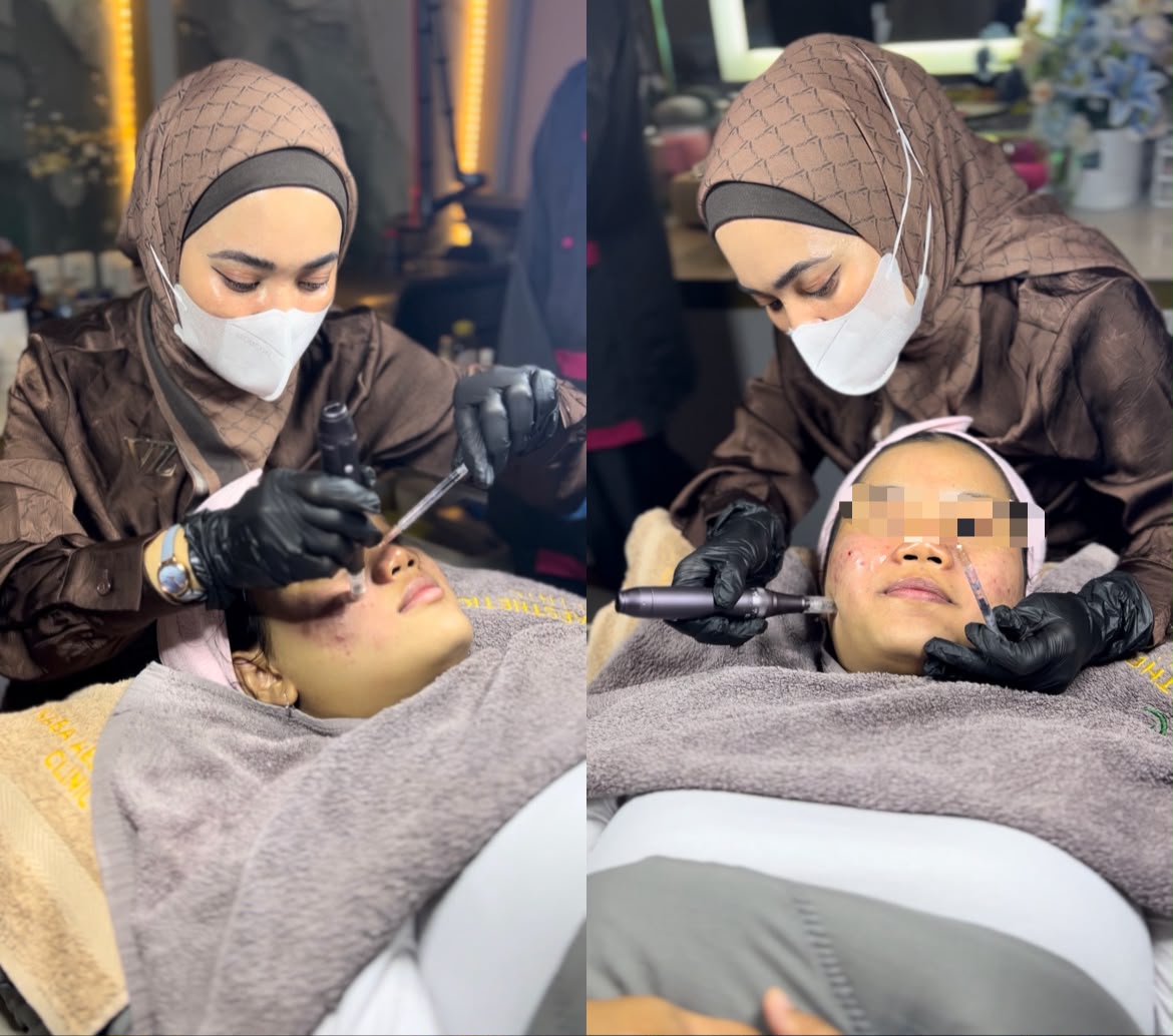 Exosome Brightening di Tangerang: Harga, Prosedur, dan Hasilnya