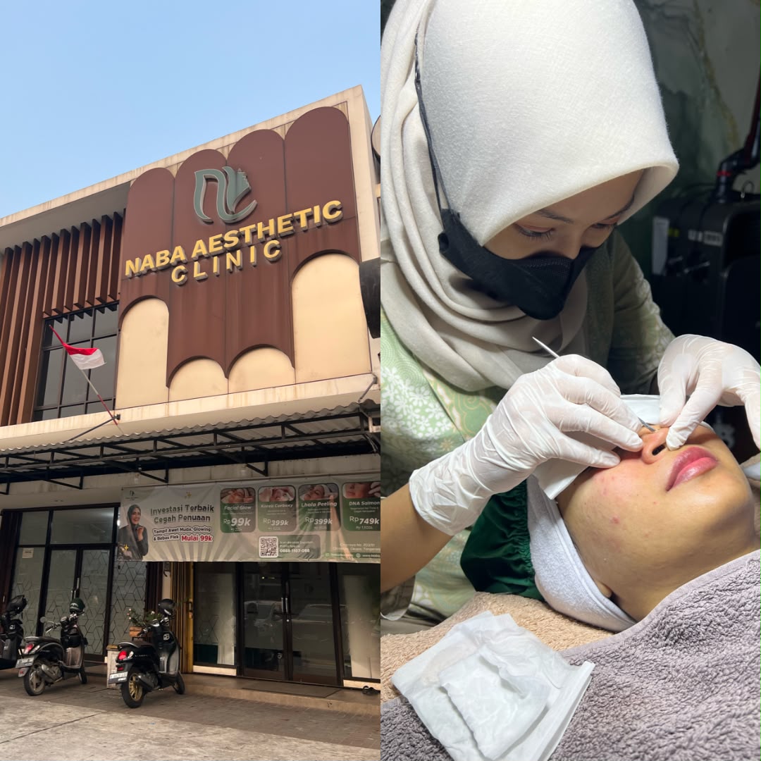 Beautician melakukan ekstraksi komedo saat facial di klinik dokter Naba Aesthetic Clinic Citra Raya