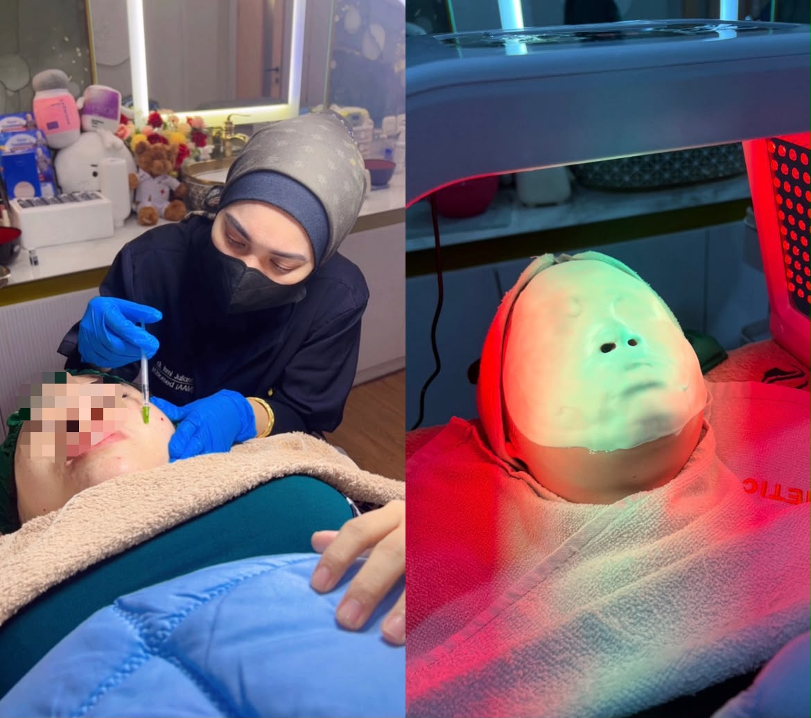 perawatan wajah untuk usia 30-an