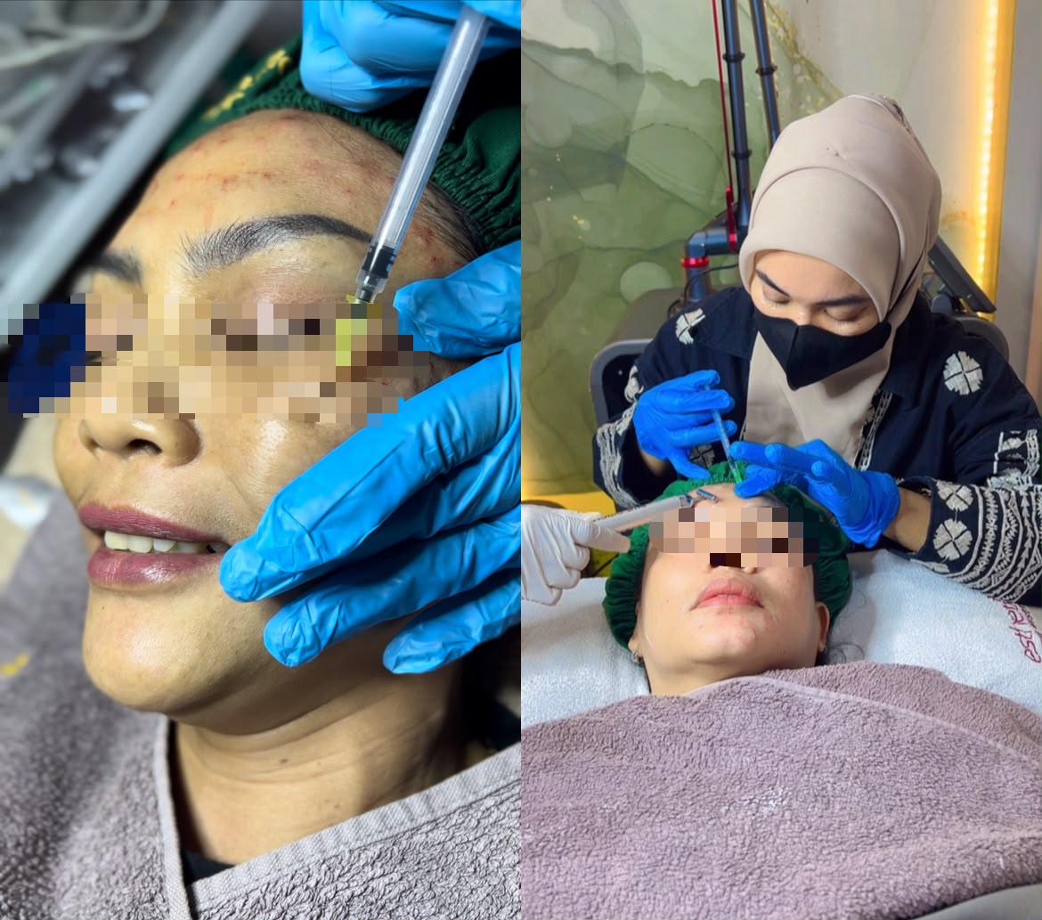 perawatan di usia 40-an