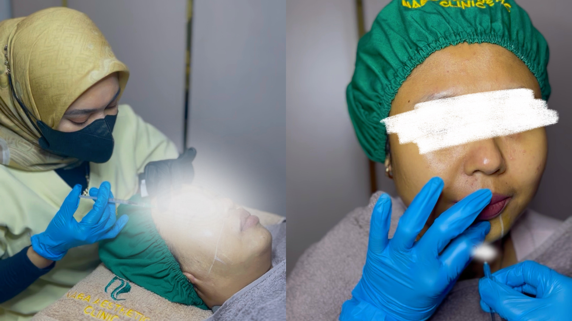 Treatment Botox dan Filler di Klinik Kecantikan Citraraya - Tangerang
