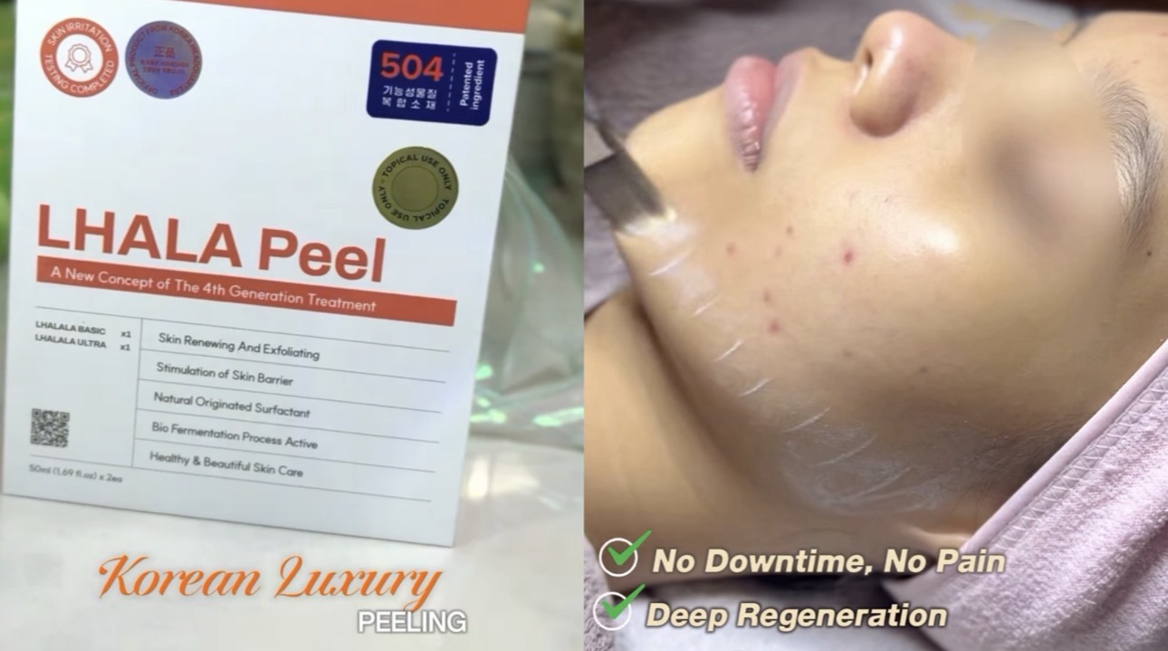 Analisis perawatan tren Glass Skin LHALA Peel di Naba Aesthetic Clinic Citra Raya Tangerang 2026.