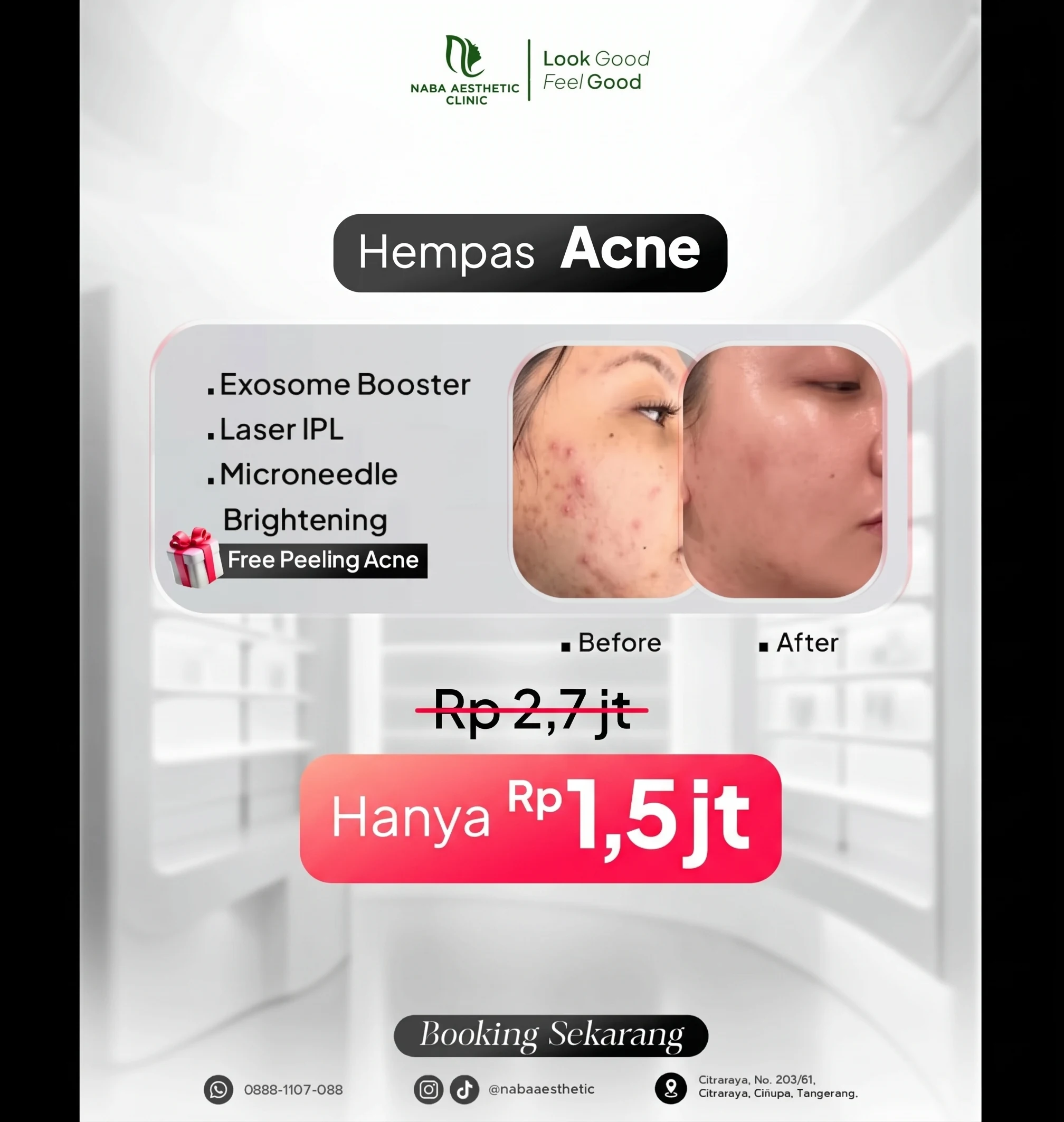 Hempas Acne di Naba Aesthetic Clinic Citra Raya Tangerang