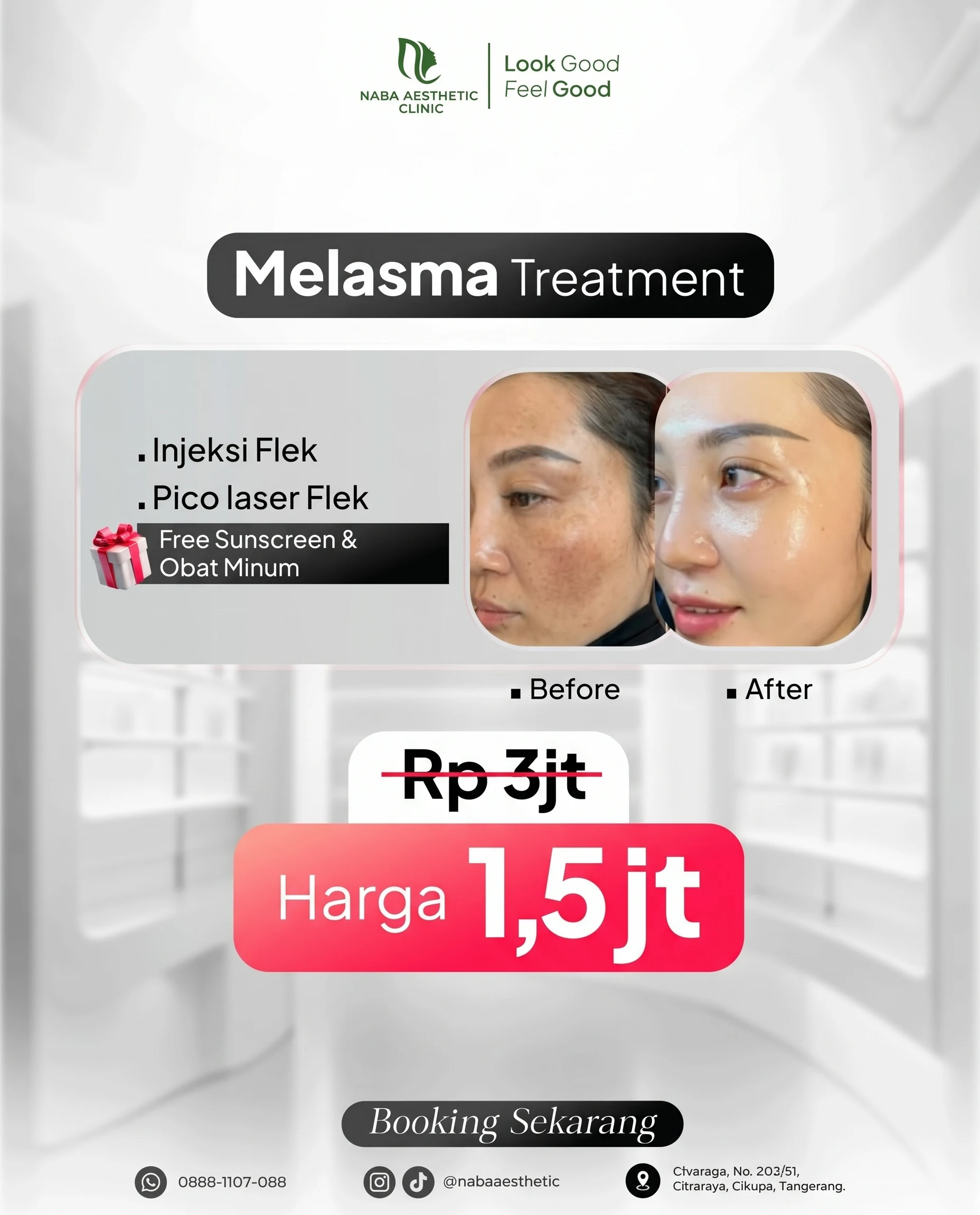 Melasma Treatment di Naba Aesthetic Clinic Citra Raya Tangerang
