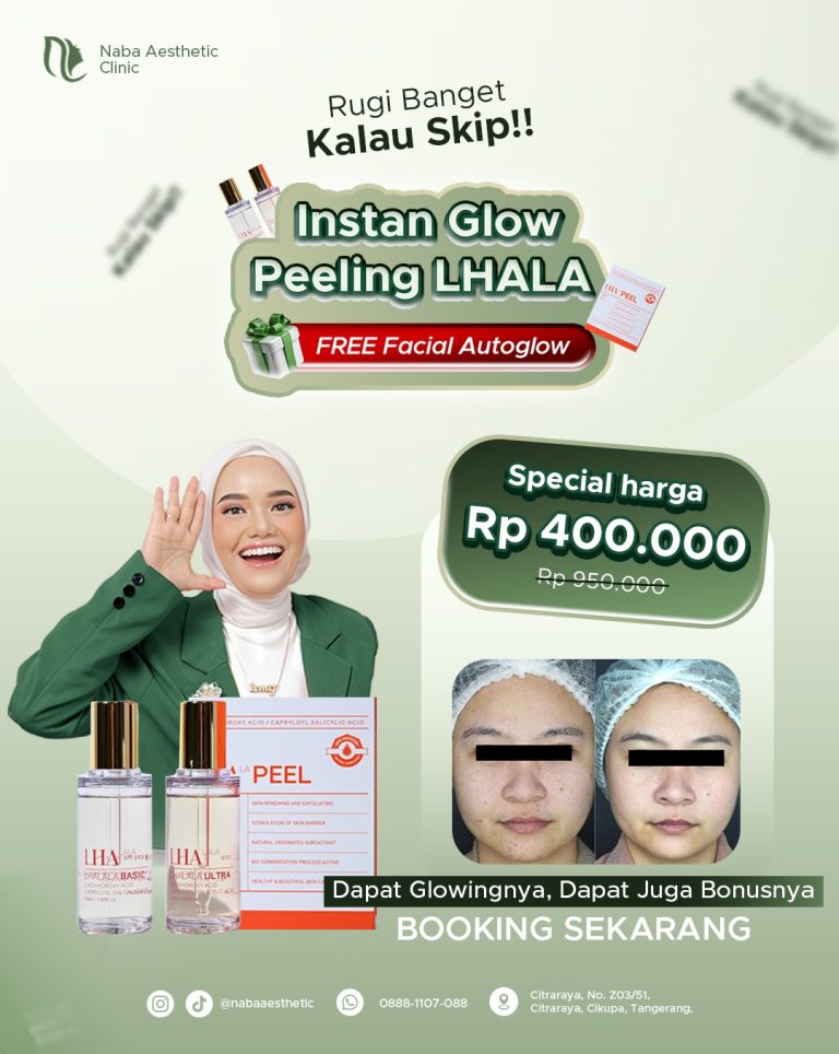 Promo Instan Glow Peeling LHALA di Naba Aesthetic Clinic dengan bonus free Facial Autoglow hanya Rp400 ribu untuk kulit glowing dan cerah