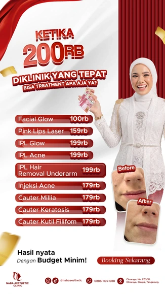 Promo Treatment Klinik Kecantikan Citraraya Tangerang Agustus 2026 Mulai 100Ribu di Naba Aesthetic
